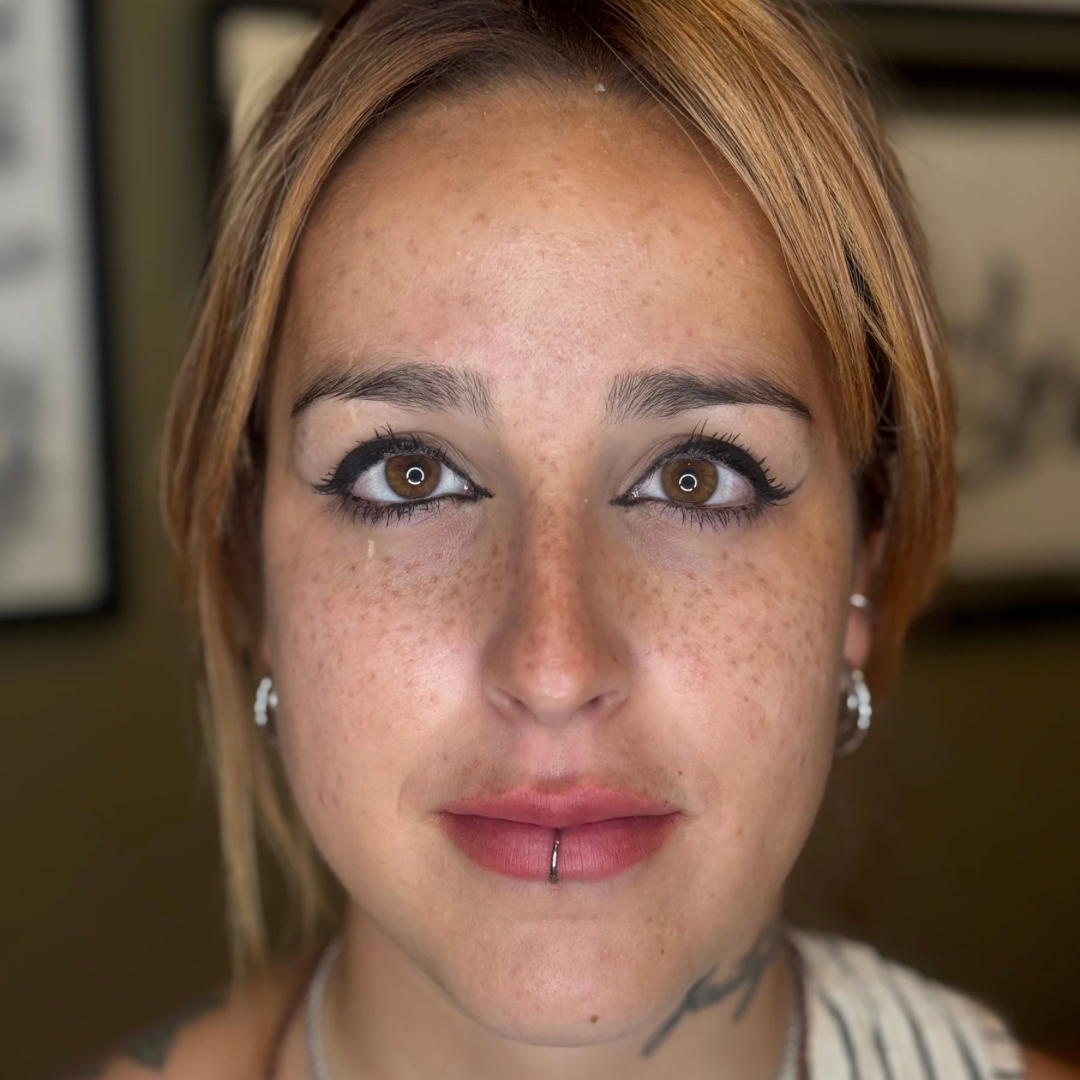 healed freckles / genezen sproetjes