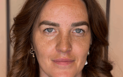 handpoked faux freckles Haarlem